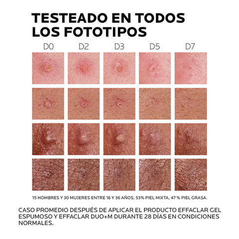 Tratamiento Anti-imperfecciones Effaclar Duo+M 40ml La Roche Posay