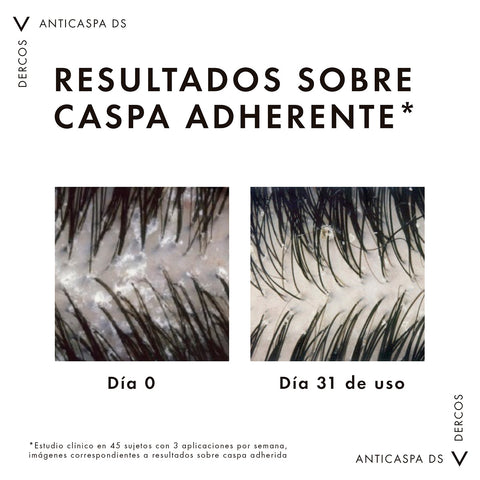 Vichy Shampoo Anticaspa Dercos DS para Cabello Graso 200ml