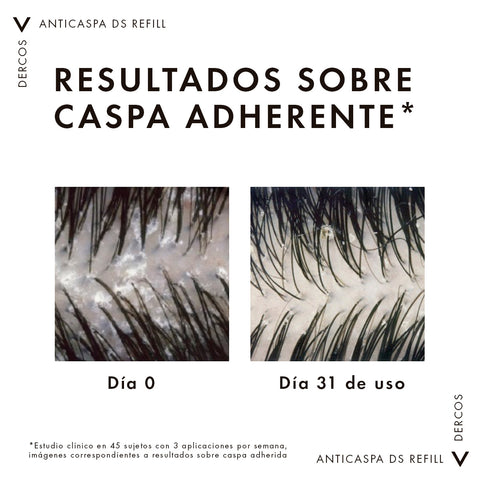 Vichy Shampoo Anticaspa Dercos DS para Cabello Graso Refill 500ml