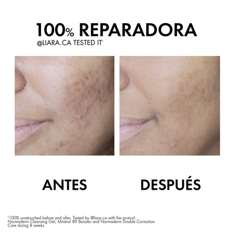 Vichy NORMADERM Crema Doble Corrección Antimperfecciones 50 ml